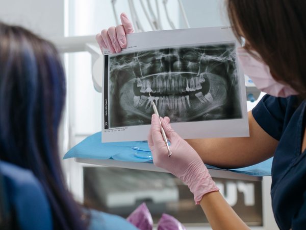 Revisión de una radiografía panorámica en la clínica